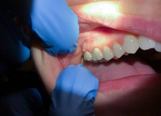 Best Root Canal Emergency Dentist  in Baker, MT